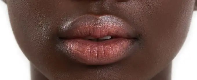 Dark Lip Neutralization Dubai