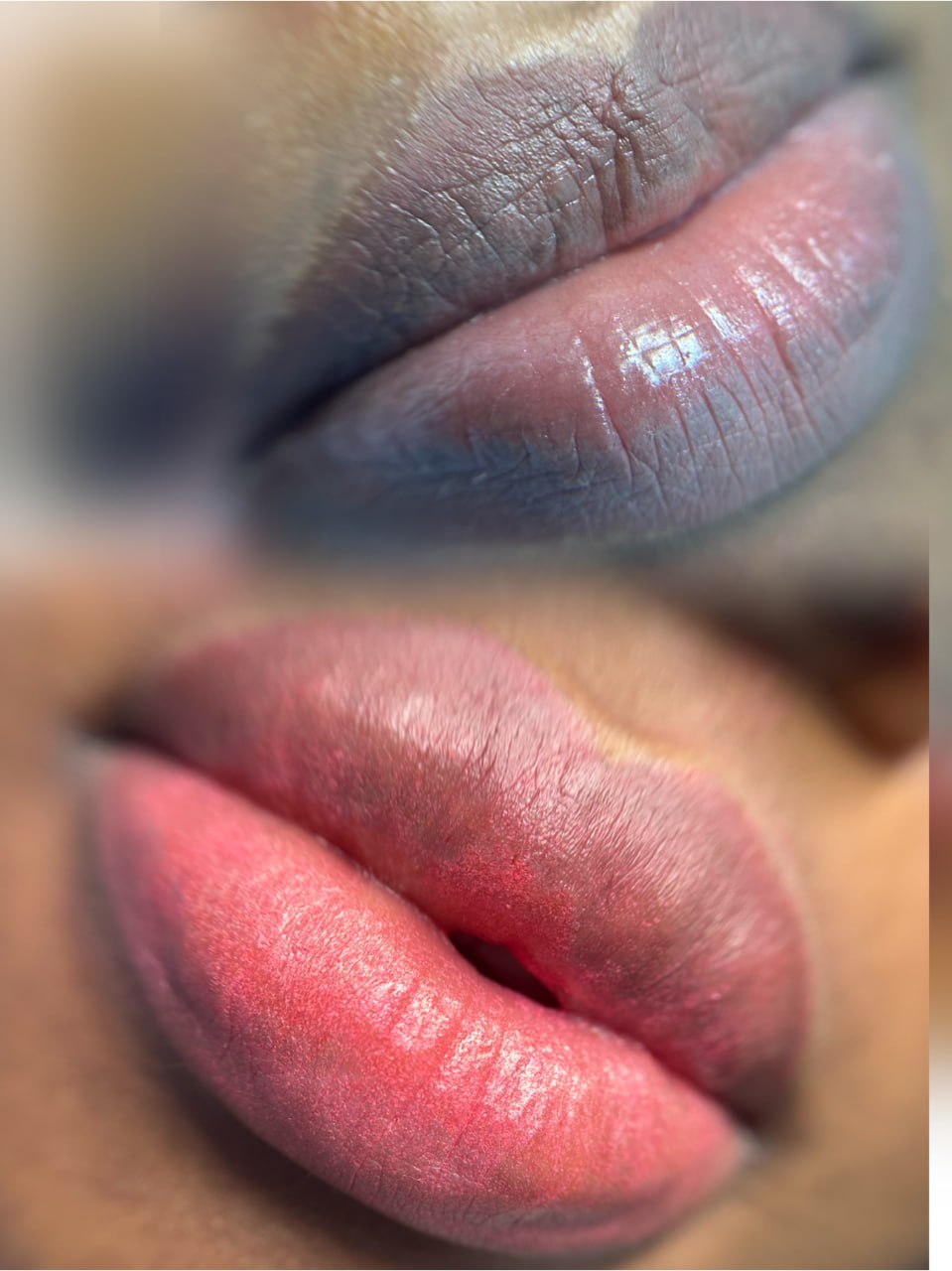 Lip Result